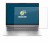 Abbildung des Geräts HP EliteBook 660 G11 mit einer Vielzahl des Displayschutzes.