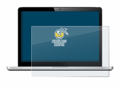 Abbildung des Geräts mit einer Vielzahl des Displayschutzes.