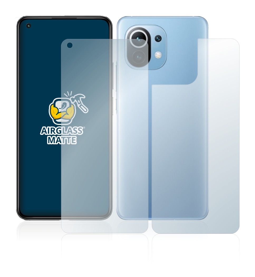 Image de l'appareil Xiaomi Mi 11 Lite 5G (Avant+Arrière) avec une grande variété de protections d'écran.