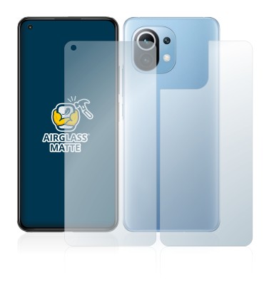 Image de l'appareil Xiaomi Mi 11 Lite 5G (Avant+Arrière) avec une grande variété de protections d'écran.